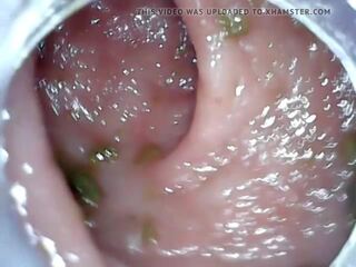 Anaali endoscope osa 1, vapaa peräruiske rankaiseminen hd aikuinen elokuva 04 | xhamster
